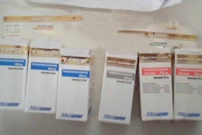 15.02.18 Versailles Frankrike